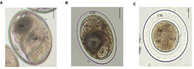 Prevalence and species identification of trematode metacercariae in Qiqihar, Northeast China